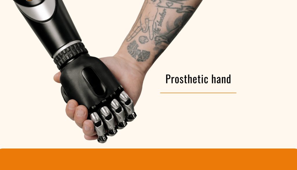 Prosthetic hand
