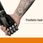 Prosthetic hand