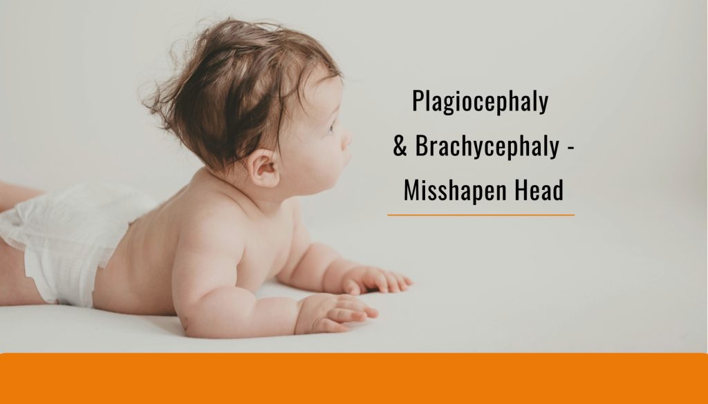 Plagiocephaly and Brachycephaly - Misshapen Head