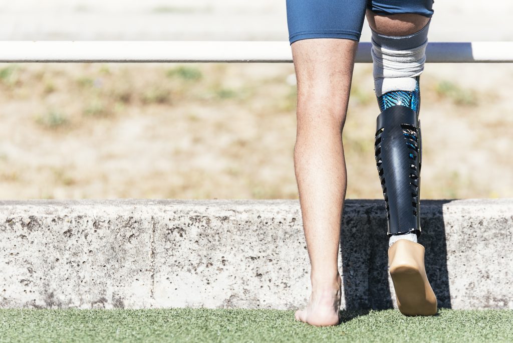 prosthetic maintenance